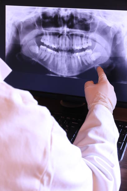 Best Broken or Cracked Tooth Emergency Dentist in Treasure Lake, PA