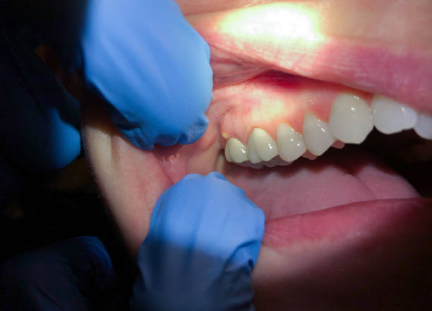 Best Pediatric Emergency Dentist in Treasure Lake, PA