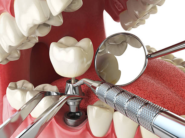Best Emergency Dental Extractions in Treasure Lake, PA
